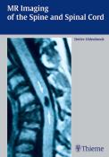 Detlev Uhlenbrock: MR Imaging of the Spine and Spinal Cord - gebunden