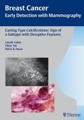 Peter B. Dean: Casting Type Calcifications: Sign of a Subtype with Deceptive Features - gebunden
