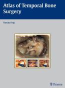 Tuncay Ulug: Atlas of Temporal Bone Surgery - gebunden