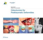 Ronald J. van Heerwaarden: Osteotomies for Posttraumatic Deformities - gebunden