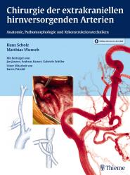Matthias Wunsch: Chirurgie der extrakraniellen hirnversorgenden Arterien