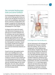 Jürgen-Michael Stein: Wirksame Hilfe bei Morbus Crohn und Colitis ulcerosa - Taschenbuch