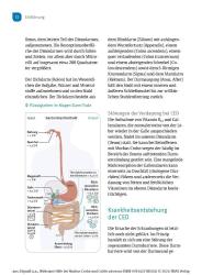 Jürgen-Michael Stein: Wirksame Hilfe bei Morbus Crohn und Colitis ulcerosa - Taschenbuch