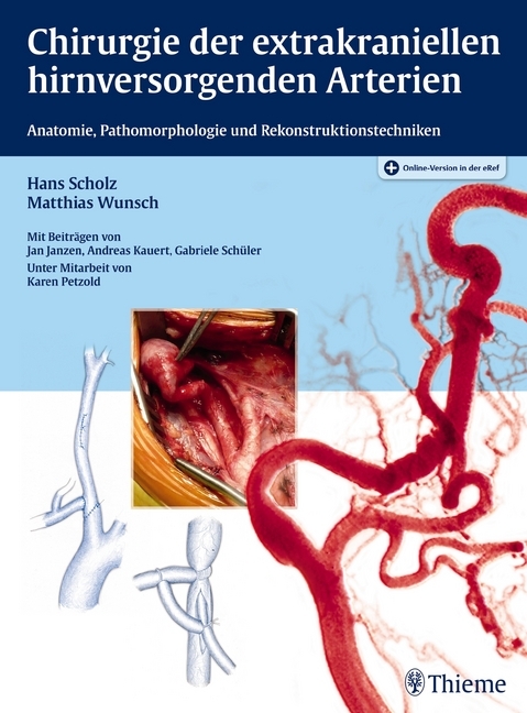 Matthias Wunsch: Chirurgie der extrakraniellen hirnversorgenden Arterien