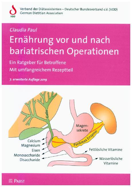 Claudia Paul: Ernährung vor und nach bariatrischen Operationen - Taschenbuch