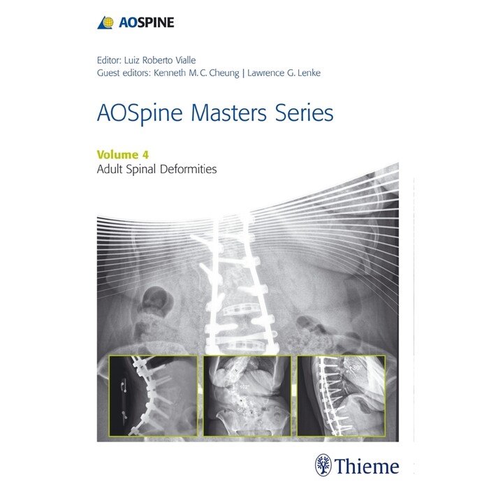 AOSpine Master Series - Adult Spinal Deformities - gebunden