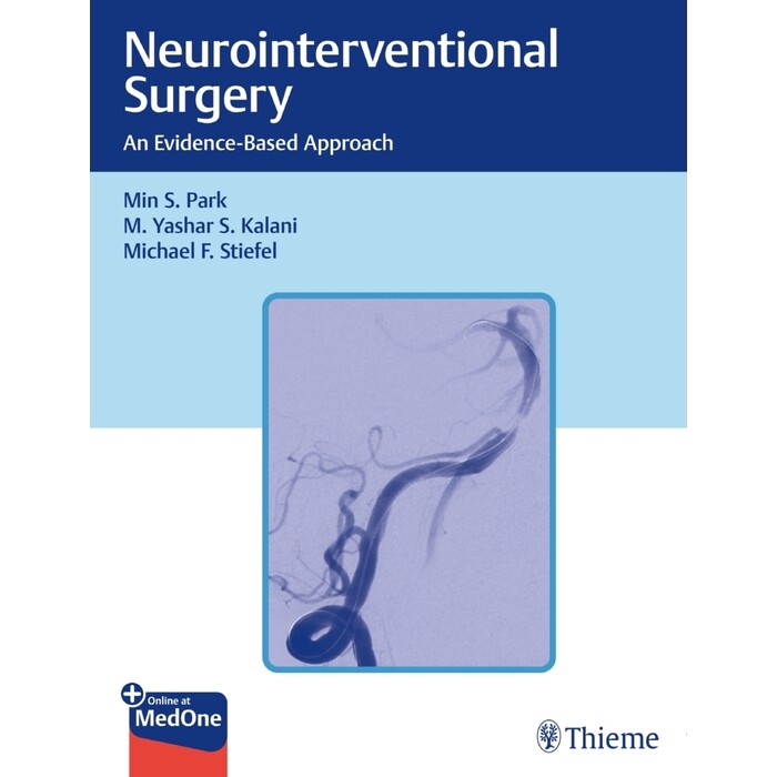 Michael Stiefel: Neurointerventional Surgery