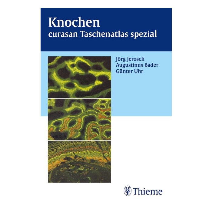 Günter Uhr: Knochen - Taschenbuch