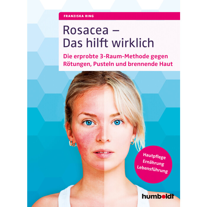 Franziska Ring: Rosacea - Das hilft wirklich - Taschenbuch