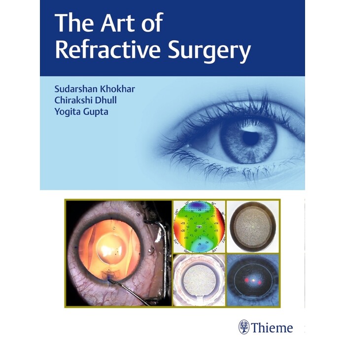 The Art of Refractive Surgery - gebunden